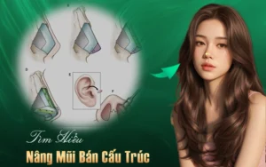 nâng mũi bán cấu trúc