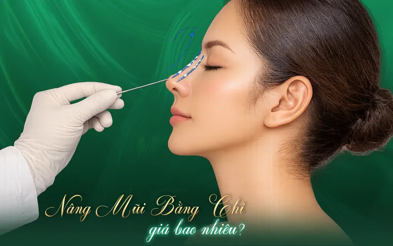 Nâng mũi bằng chỉ giá bao nhiêu