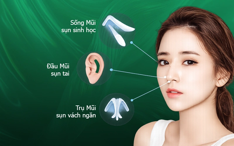 Tất Tần Tật Về Nâng Mũi Cấu Trúc: Ưu Điểm, Chi Phí & Lưu Ý nâng mũi cấu trúc là gì