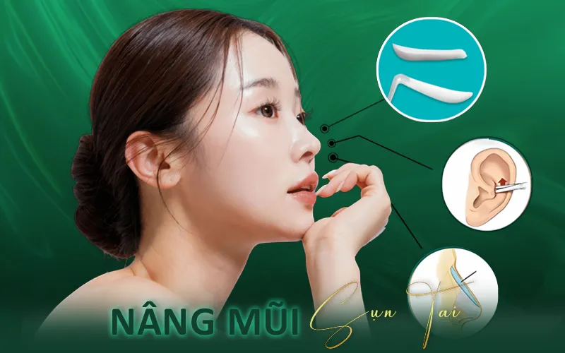 yếu tố ảnh hưởng chi phí nâng mũi sụn tai
