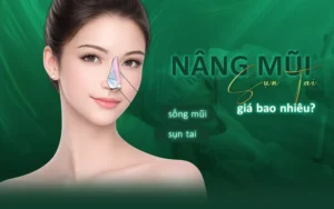 nâng mũi sụn tai giá bao nhiêu