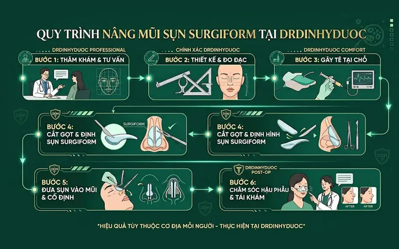 Nâng Mũi Sụn Surgiform Có Tốt Không? Ưu Điểm, Hạn Chế Và Quy Trình Nâng Mũi Sụn Surgiform Quy trình nâng mũi sụn surgiform tại Drdinhyduoc