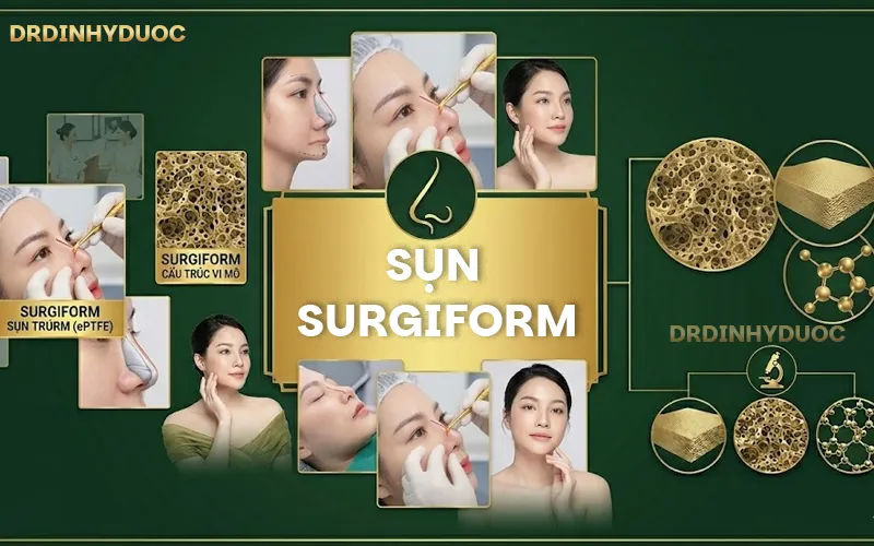 Nâng Mũi Sụn Surgiform Giá Bao Nhiêu Và Yếu Tố Ảnh Hưởng Chi Phí Nâng Mũi nâng mũi sụn surgiform giá bao nhiêu