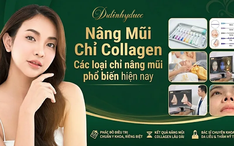 Các loại chỉ collagen phổ biến hiện nay