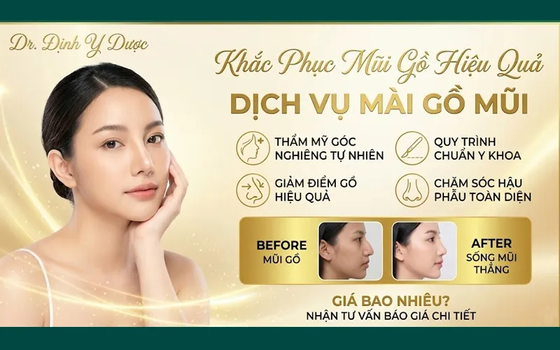 mài gồ mũi giá bao nhiêu