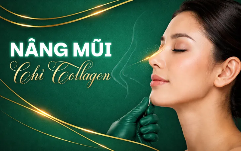 Nâng mũi chỉ collagen là gì