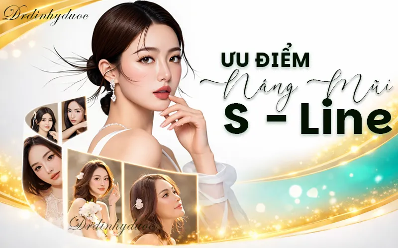 Ưu điểm của dáng mũi S Line cao tây