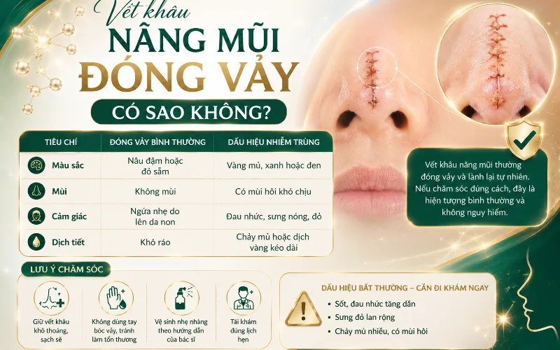 Vết khâu nâng mũi đóng vảy có nguy hiểm không