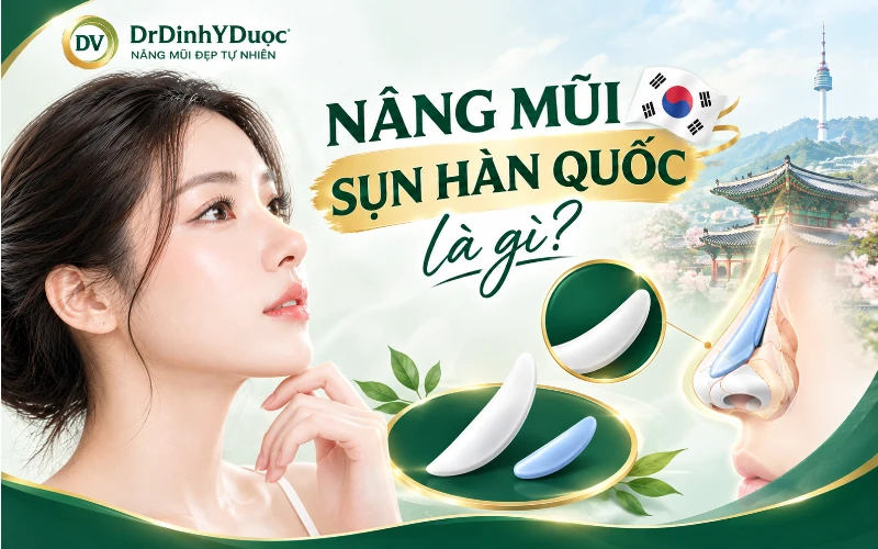 Nâng mũi sụn Hàn Quốc là gì