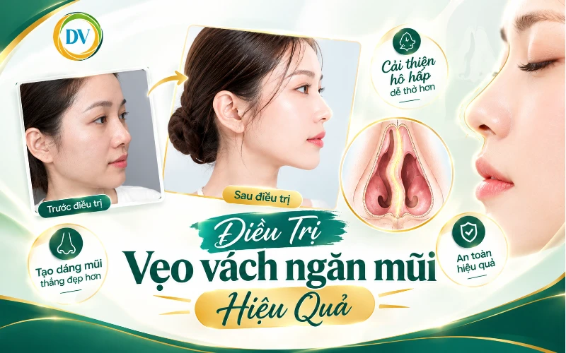 điều trị vẹo vách ngăn mũi