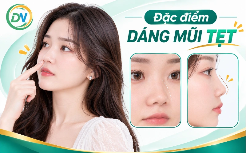 Đặc điểm của dáng mũi tẹt